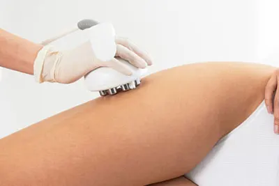 tratamento para flacidez corporal em BH