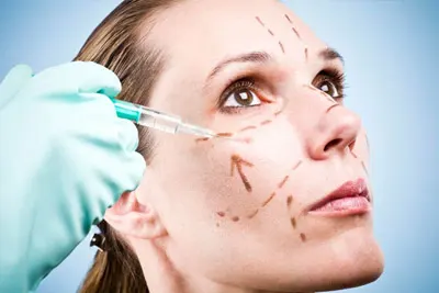preenchimento facial e lifting facial em BH