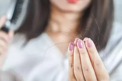 tratamento para queda de cabelo em BH