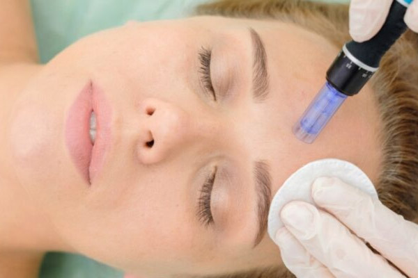 Intradermoterapia Facial