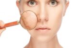 Melasma: entenda o que é e como identificar essa alteração pigmentar!