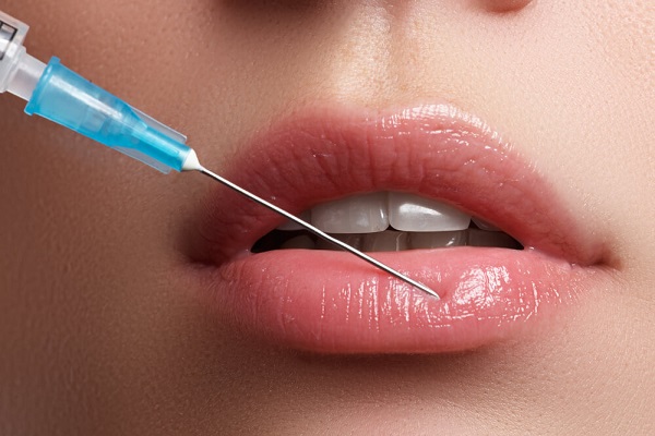 Preenchimento labial: descubra como ter lábios mais bonitos e naturais!