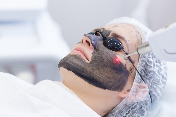 Descubra o segredo por trás do Black Peel: o procedimento de rejuvenescimento facial que está conquistando corações!