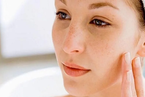 Estratégias inovadoras para combater o Melasma!