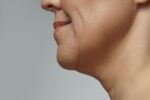 Bigode Chinês: como lidar com as linhas de expressão facial?