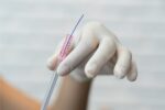 Cicatrizes dérmicas: o papel dos fios de PDO no tratamento de estrias!